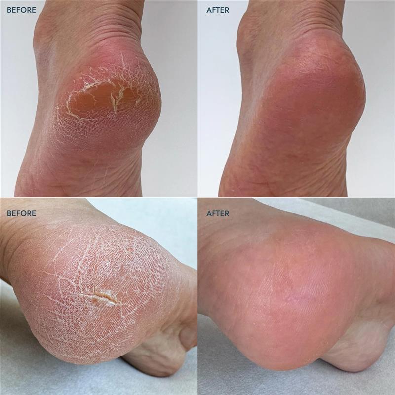 SoleMate Heel Repair Balm ~ Lavender